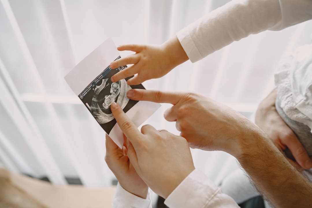 fotoseputar